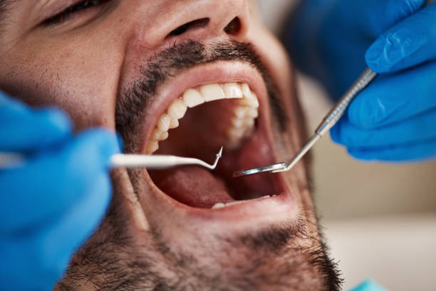 Best Emergency Treatment for Toothache in Caoncito, NM